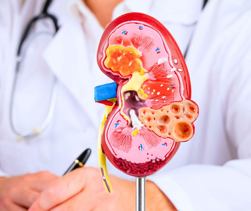 Nephrology Consultation