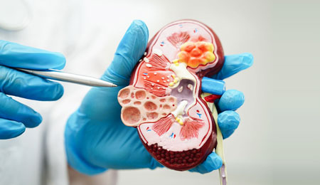 Chronic Kidney Disease