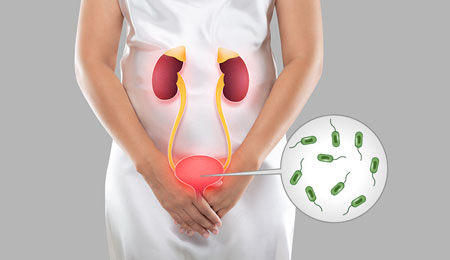 Urinary Tract Infections