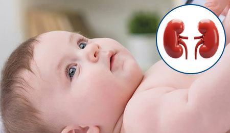 Congenital Kidney and Urinary Tract Anomalies