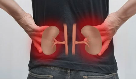 Electrolyte Abnormalities