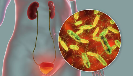 Asymptomatic Urinary Abnormalities